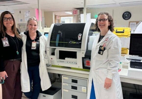 Coagulation Analyzer